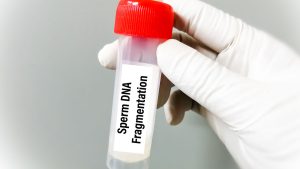 Sperm DNA Hasar (Fragmantasyon) Testi Nedir?