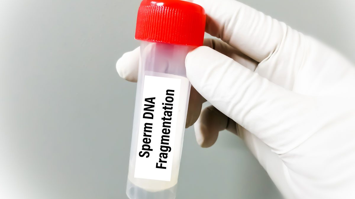 Sperm DNA Hasar (Fragmantasyon) Testi Nedir? Sperm DNA Hasar (Fragmantasyon) Testi Nedir?