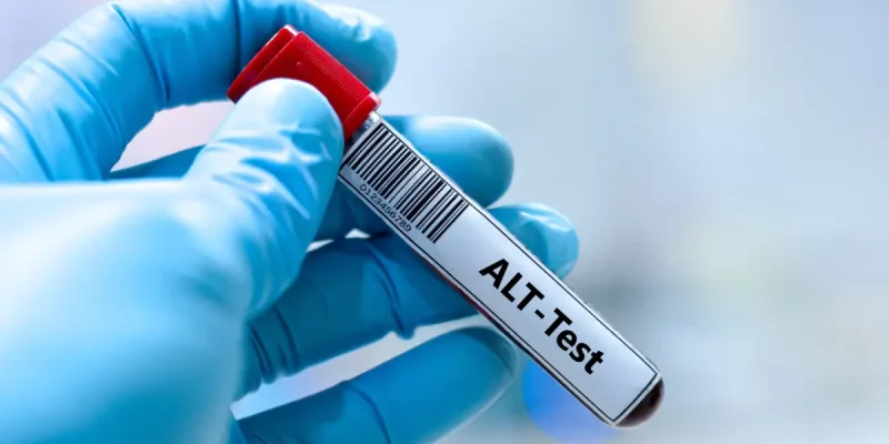 ALT Testi Nedir?