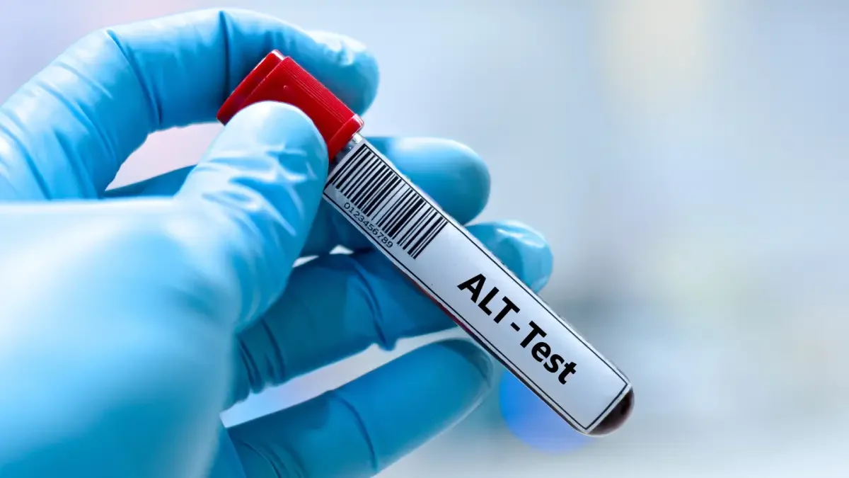 ALT Testi Nedir?