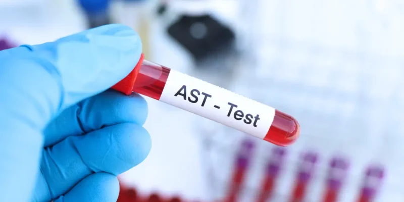AST Testi Nedir?