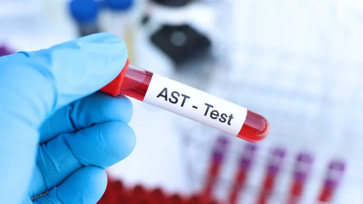 AST Testi Nedir?