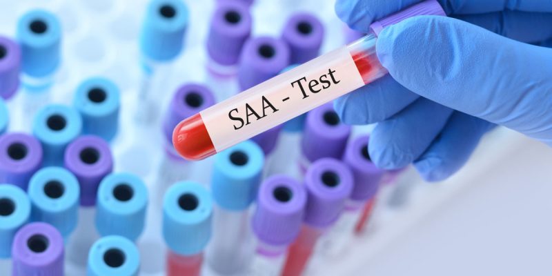 Amiloid A Testi Nedir?