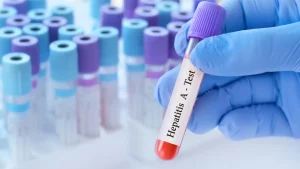 Anti HAV IgG Testi