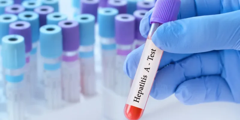Anti HAV IgG Testi Nedir? Nasıl Bulaşır?