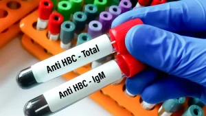 Anti HBc Testi