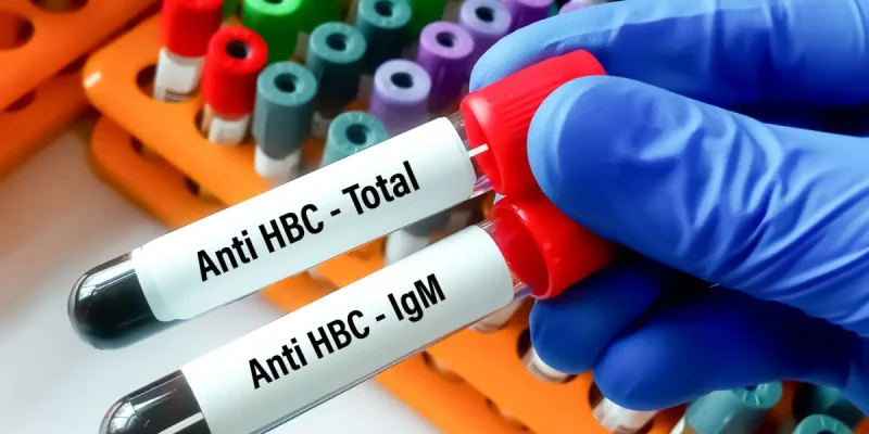 Anti HBc Testi Nedir?