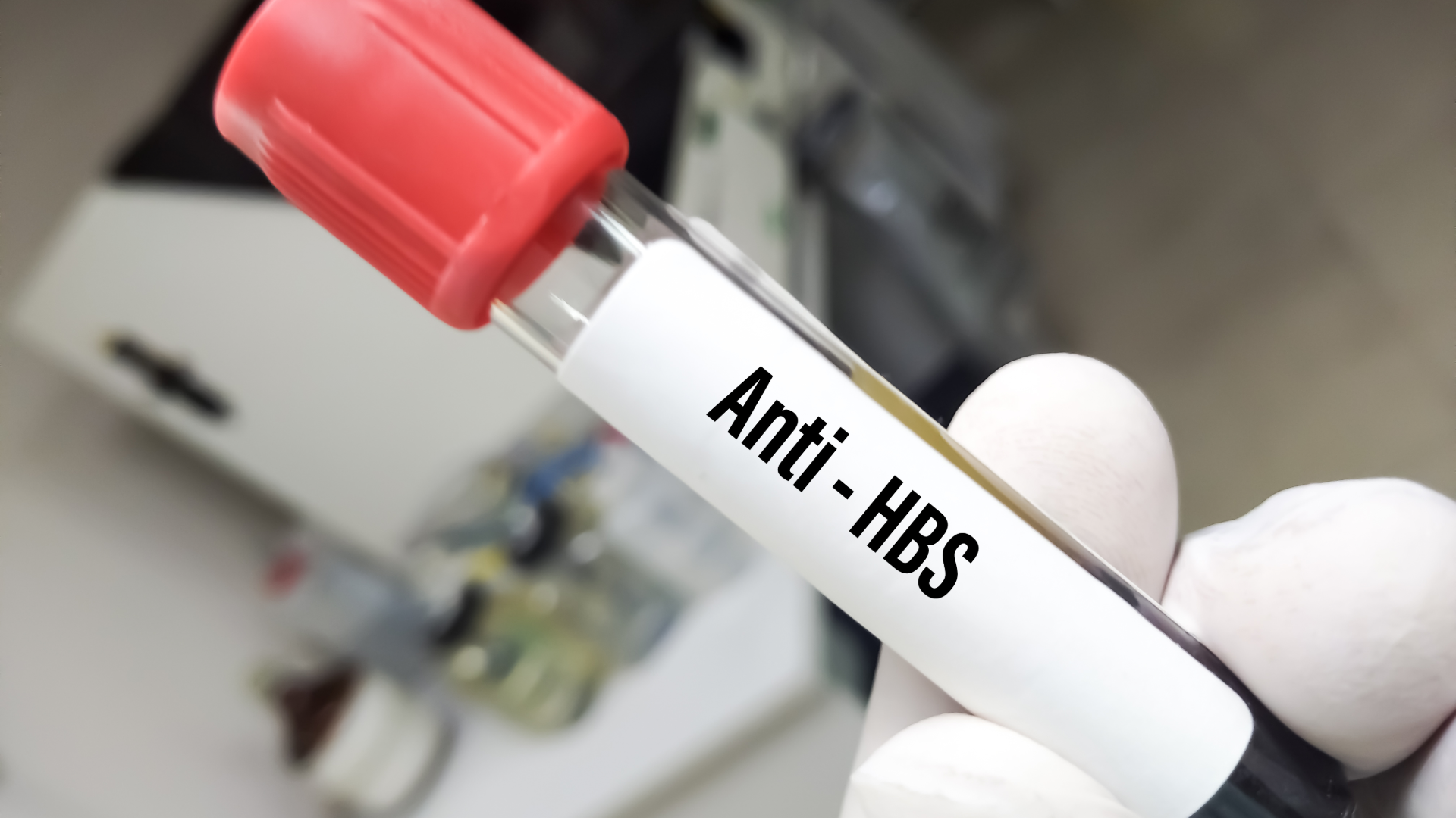 Anti HBs Testi Nedir?