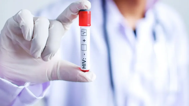 Anti HIV Kemiluminesans