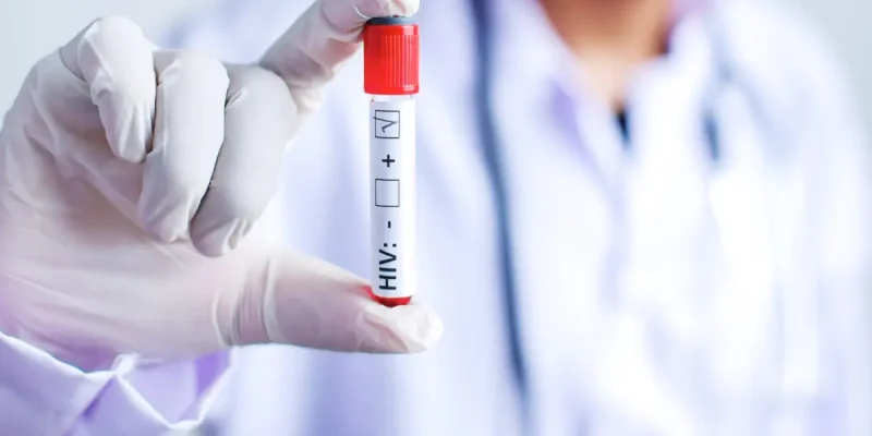 Anti HIV Kemiluminesans Nedir?