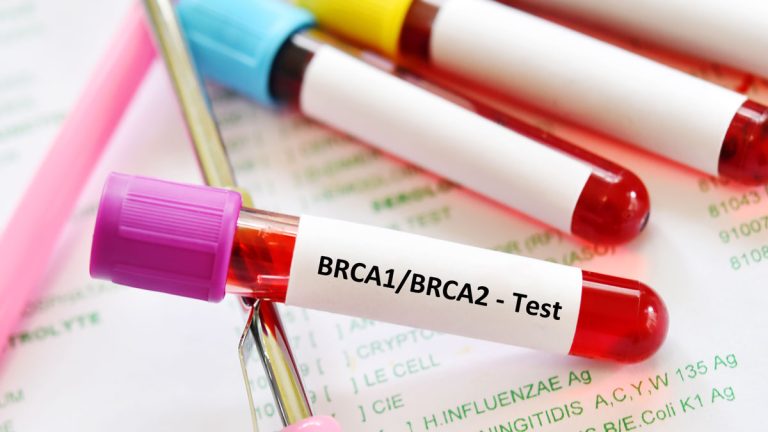 BRCA Testi