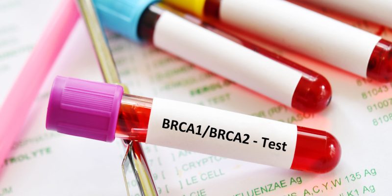 BRCA Testi Nedir?