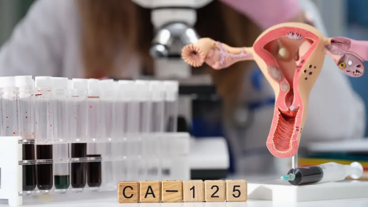 CA 125 Testi Nedir?