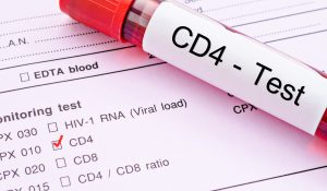 CD4 Testi