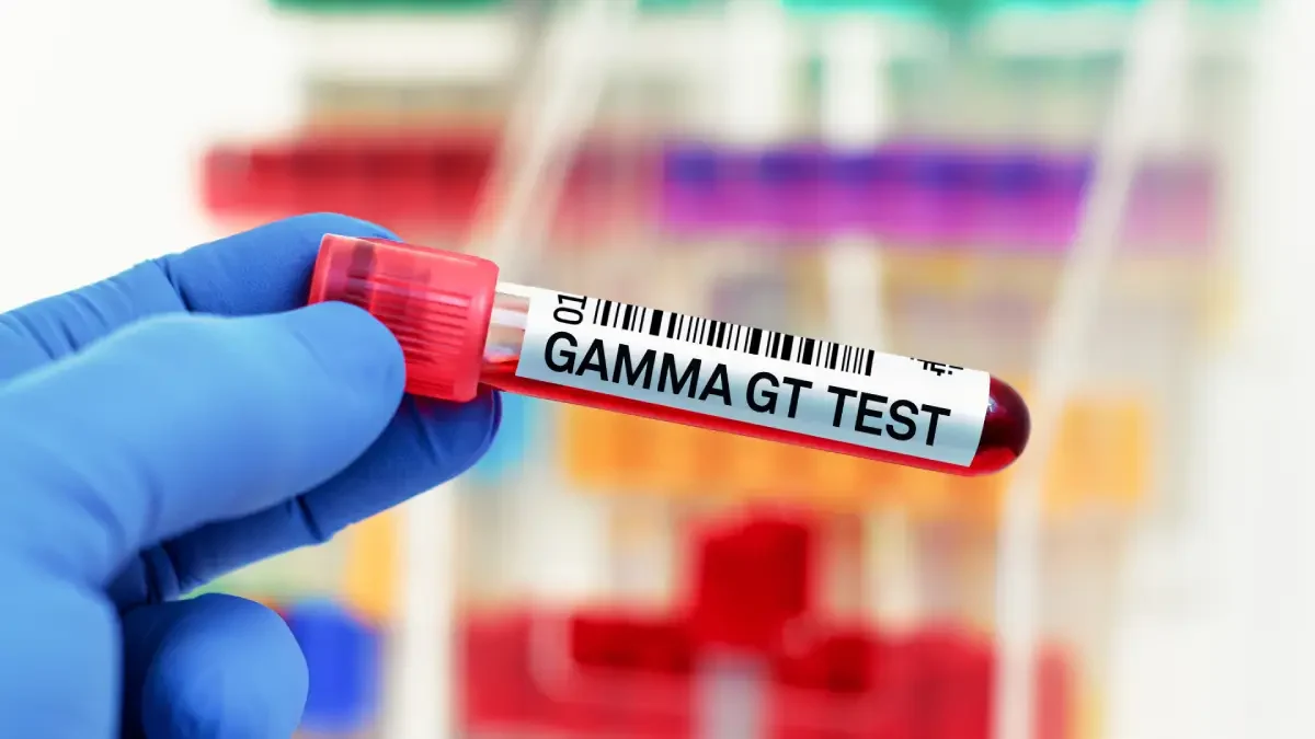 GGT Testi Nedir?