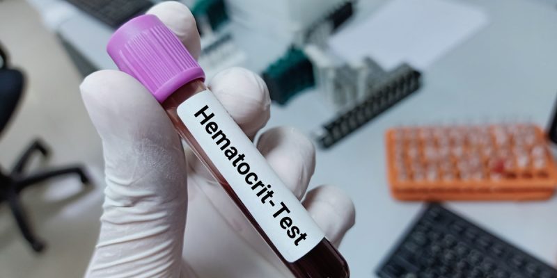 HCT (Hematokrit) Nedir?