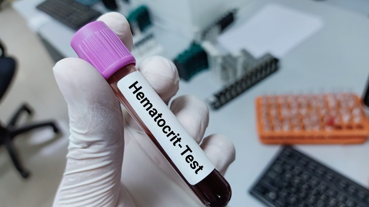 HCT (Hematokrit) Nedir?
