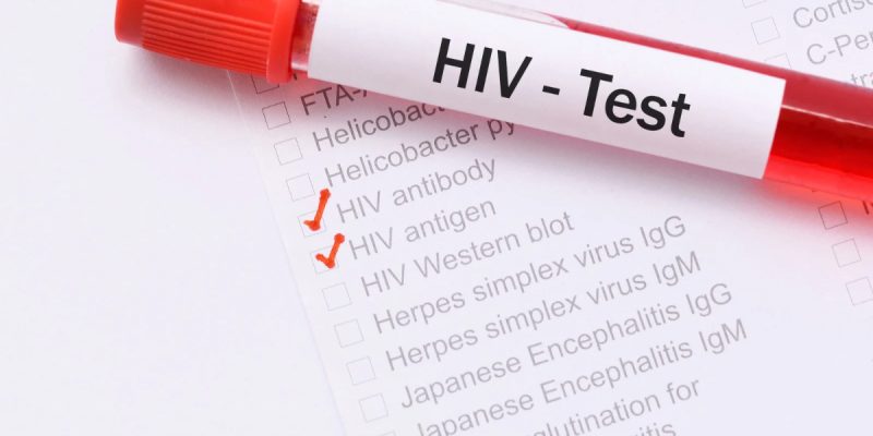 HIV Testi Ne Zaman Yapılmalı?