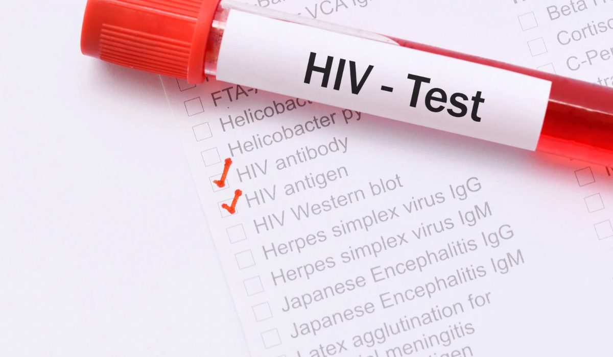 HIV Testi Ne Zaman Yapılmalı?