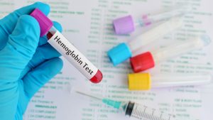 Hemoglobin Elektroforezi Testi