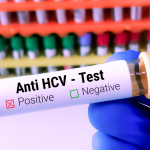 Anti HCV Testi