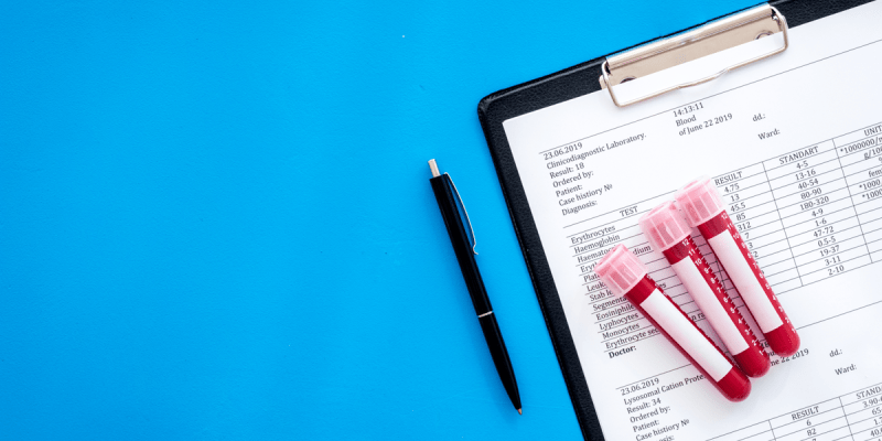 Kanda Alerji Testi Değerleri