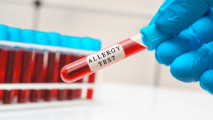 Kandan Alerji Testi Nedir?