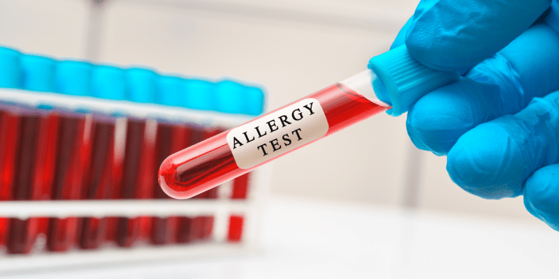 Kandan Alerji Testi Nedir?