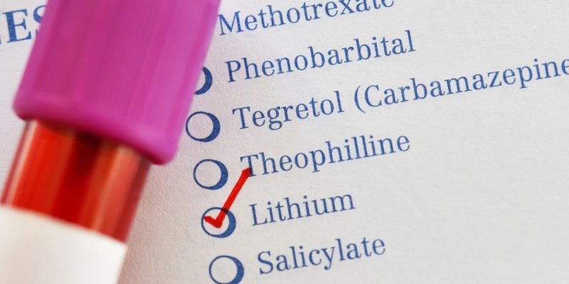 Lityum Testi Nedir?