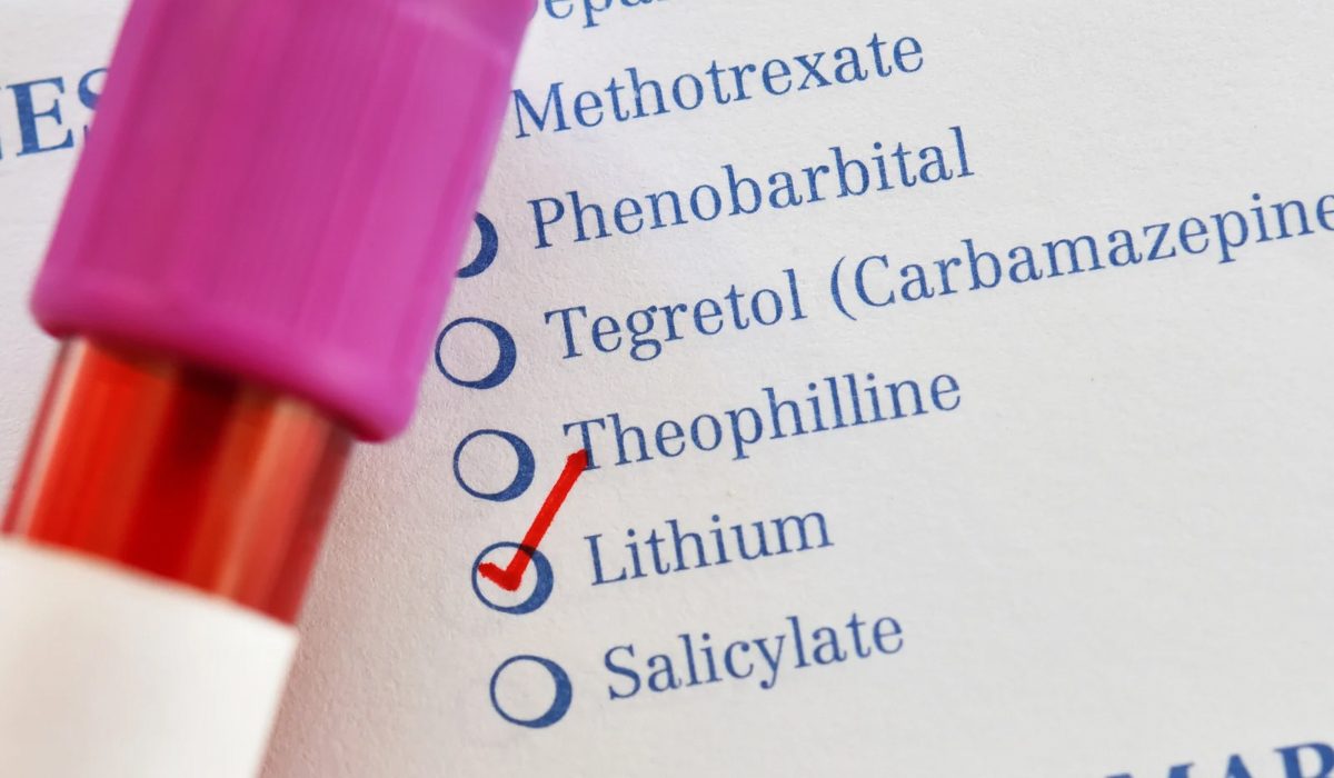 Lityum Testi Nedir?
