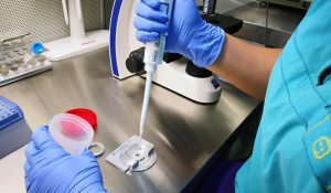 Spermiogram Testi Nasıl Yapılır?