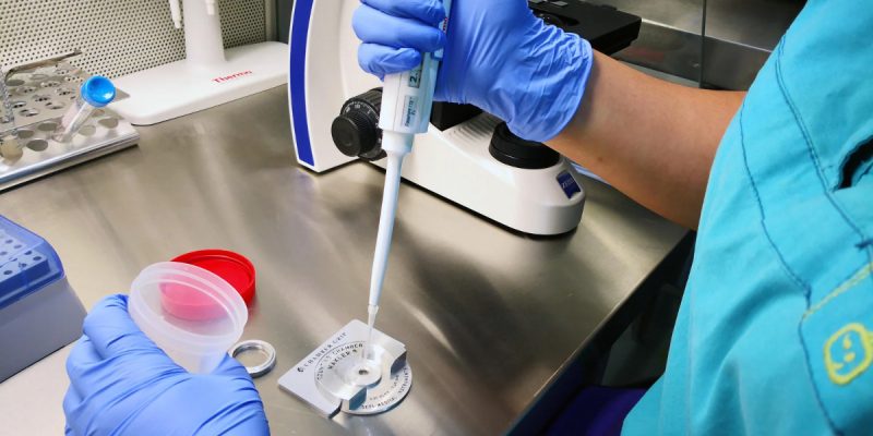 Spermiogram Testi Nasıl Yapılır?