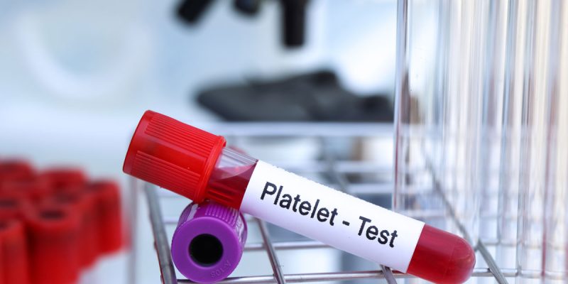 Trombosit (PLT) Nedir?