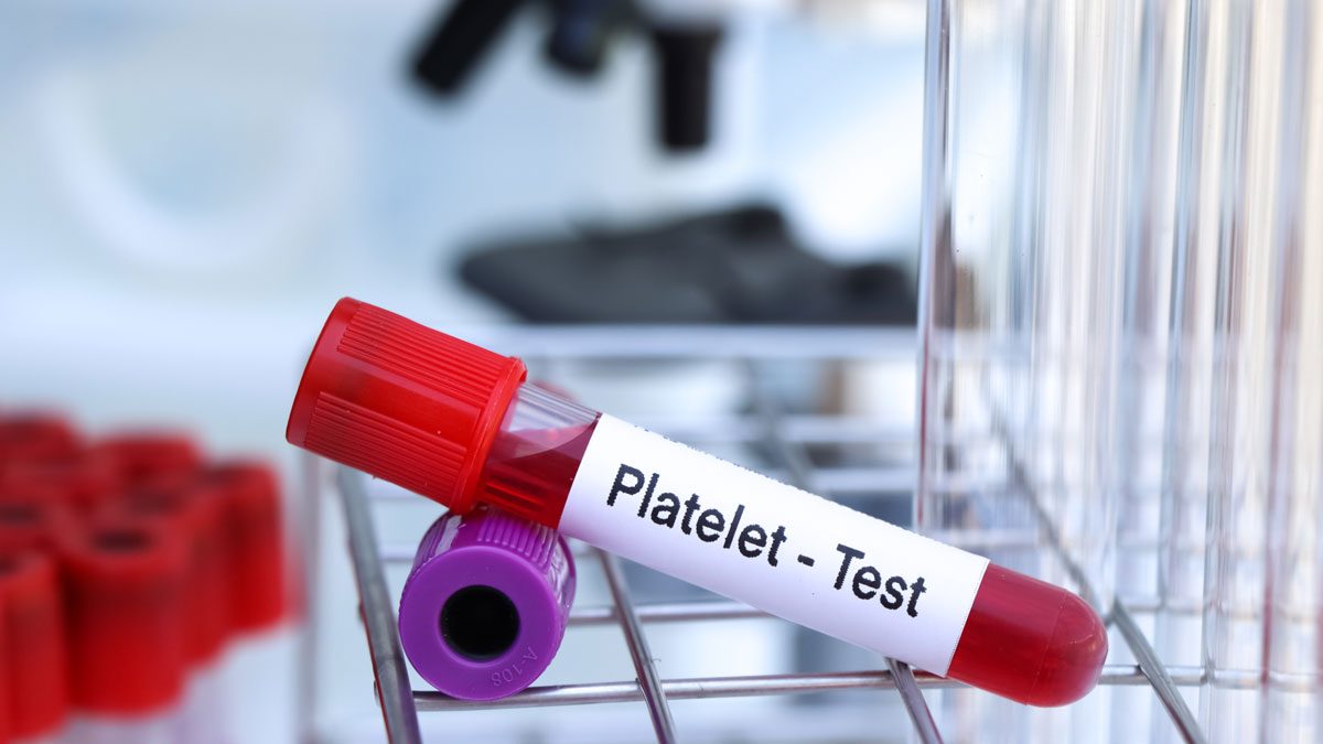 Trombosit (PLT) Nedir?