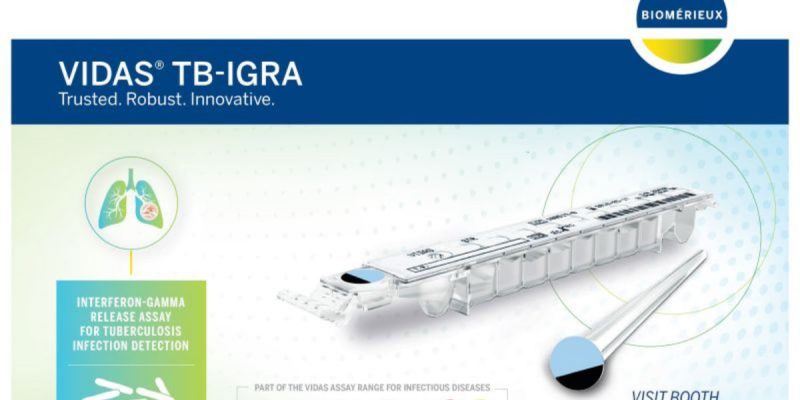 VIDAS® TB-IGRA Testi Nedir?