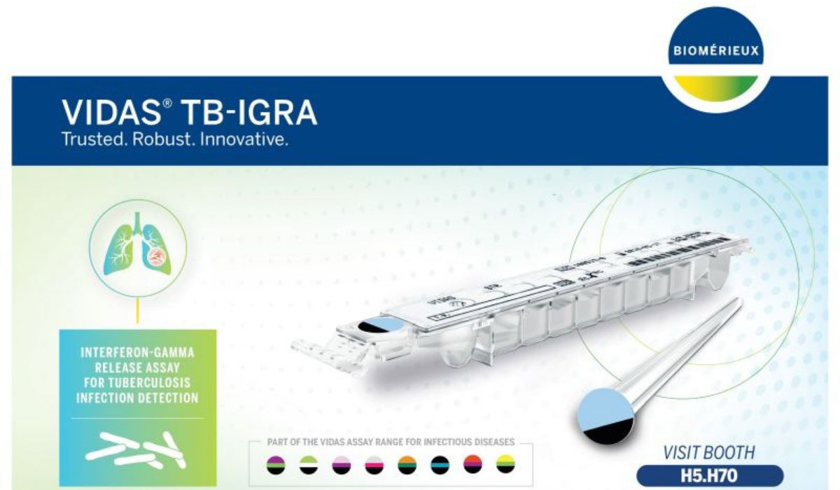 VIDAS® TB-IGRA Testi Nedir?