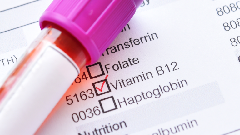 Vitamin B12 Testi