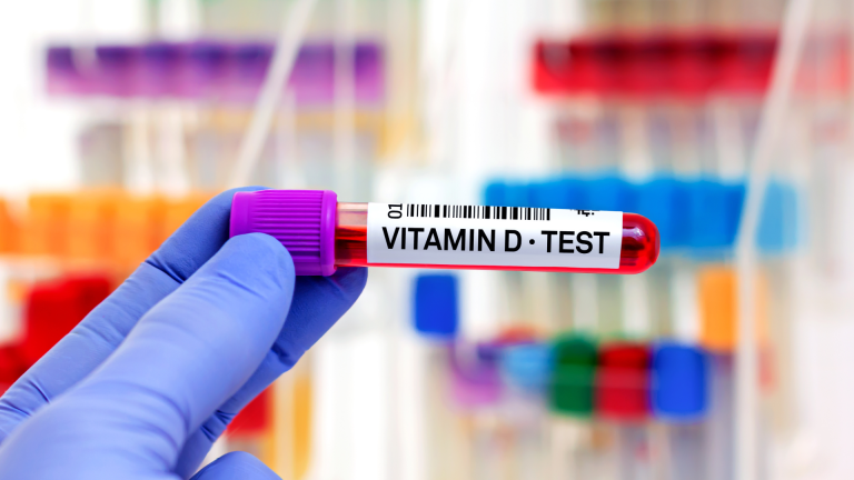 Vitamin D Testi