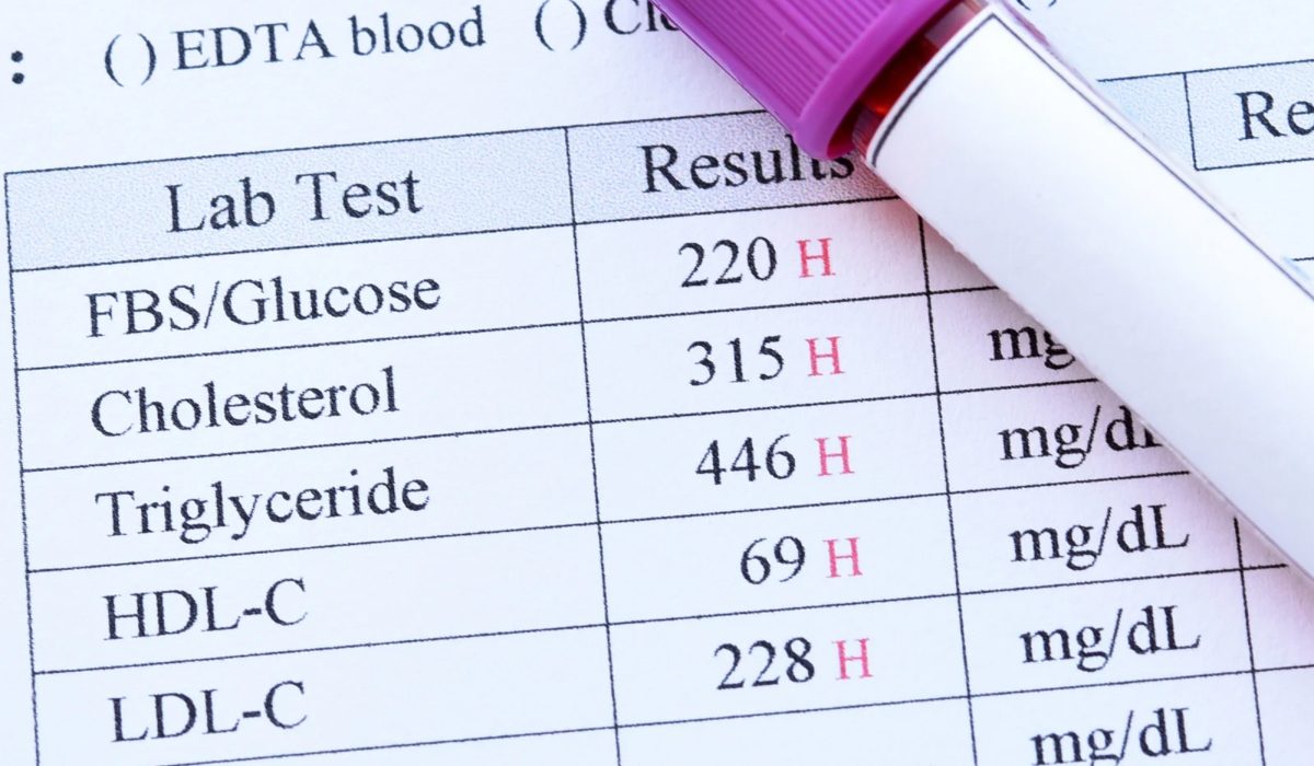 Açlık Kan Şekeri Yüksek Çıktı, Şeker Hastası mıyım?