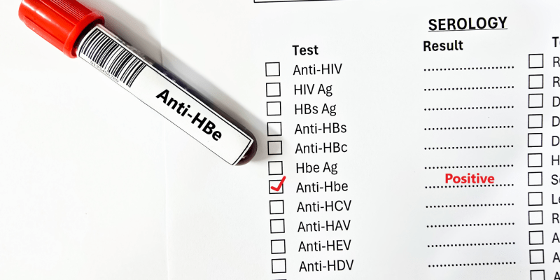 Anti HBe Testi Nedir?