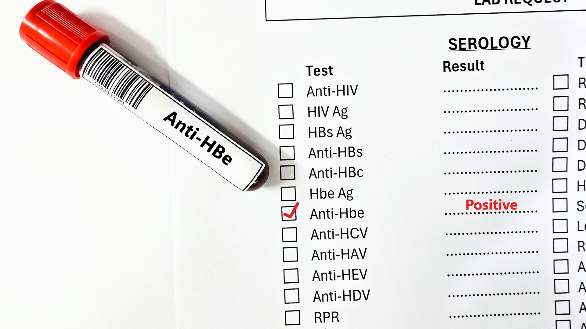 Anti HBe Testi Nedir?