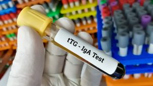 Anti Doku Transglutaminaz (tTG) Testi