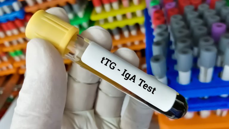 Anti Doku Transglutaminaz (tTG) Testi
