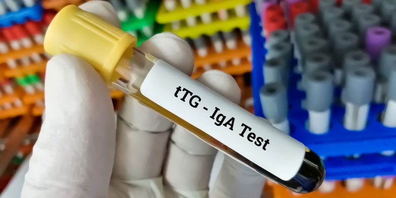 Anti Doku Transglutaminaz (tTG) Testi Nedir?