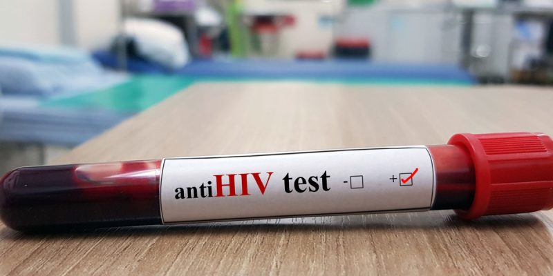 Anti HIV Testi Sonucu Negatifse Ne Yapılmalı?