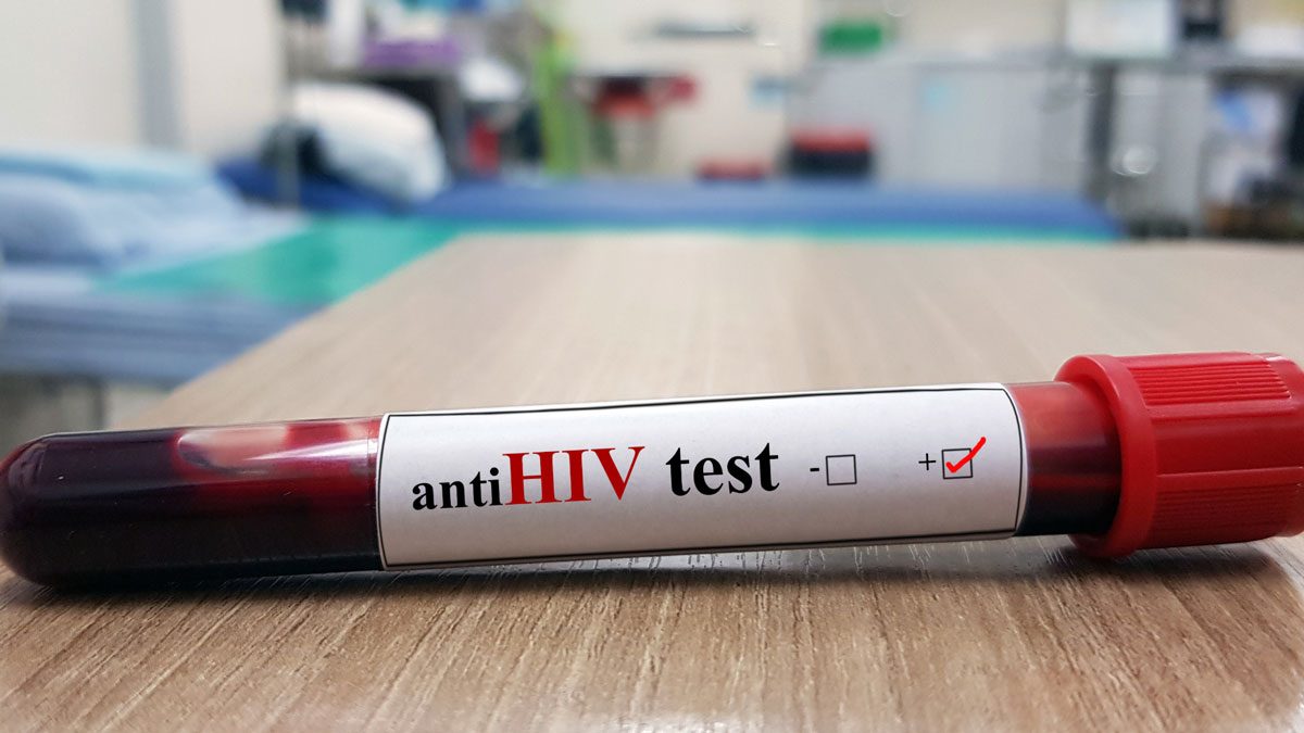 Anti HIV Testi Sonucu Negatifse Ne Yapılmalı?