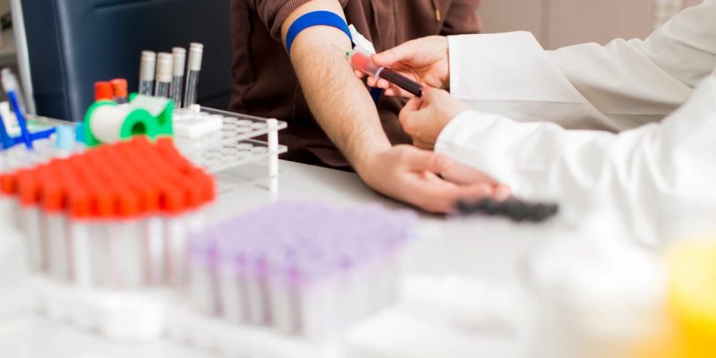 Bel Soğukluğu (Gonore) Testi