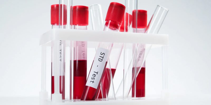 Cinsel Yolla Bulaşan Hastalıklar Paneli