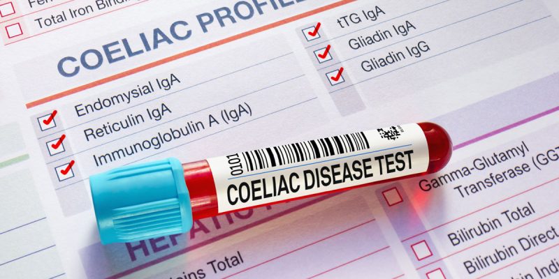 Çölyak Paneli Nedir?