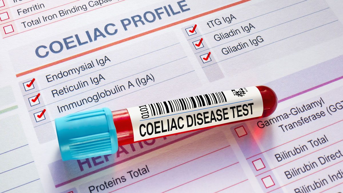 Çölyak Paneli Nedir?
